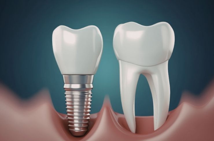 Your Dentist Dental Hospital